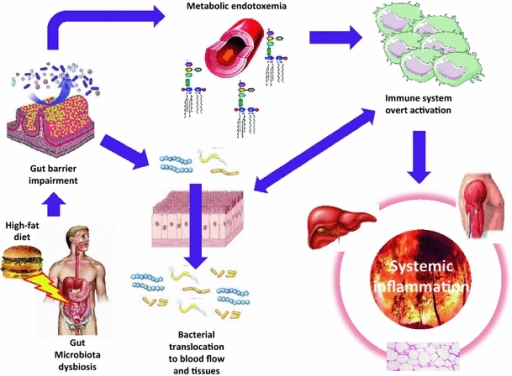 Click to enlarge Leaky gut
