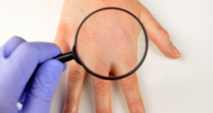 magnified skin