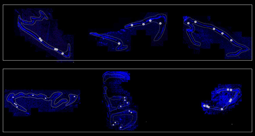 neuroplasticity, neurogenesis hippocampus