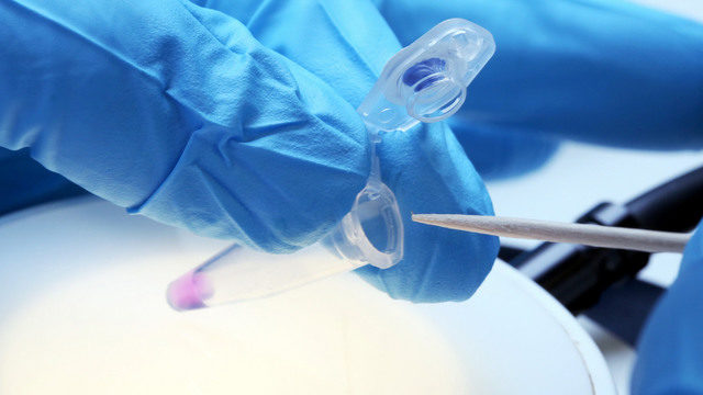 Click to enlarge Estonia genetic testing