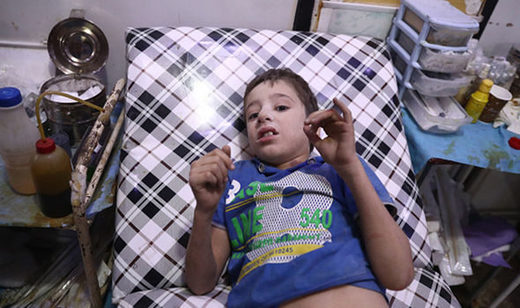 Click to enlarge chemical weapons child