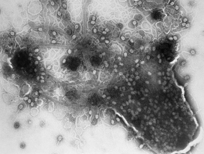 Click to enlarge virus2