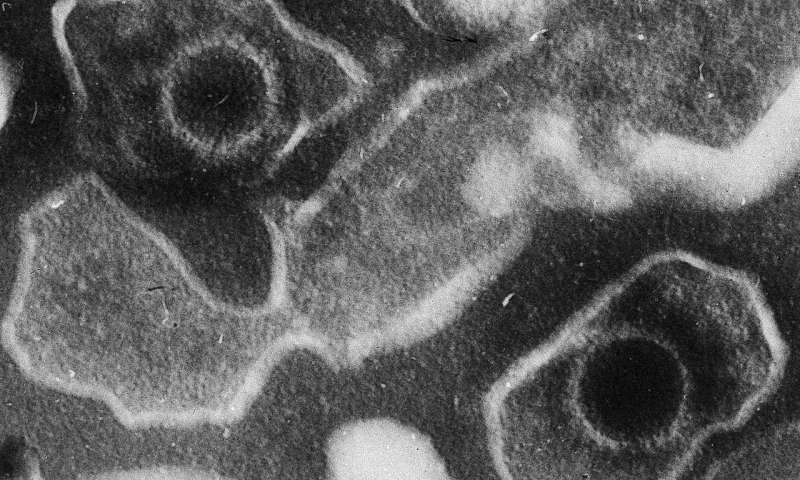 Epstein Barr Virus virions