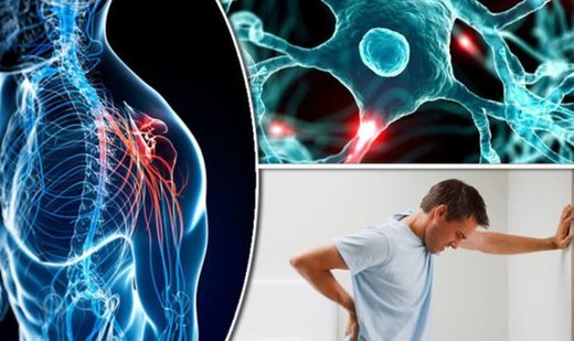 Multiple Sclerosis