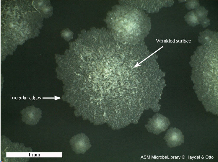 Buruli ulcer