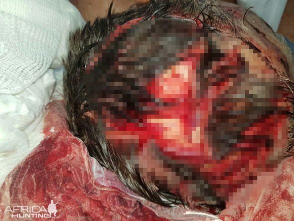 Click to enlarge Hardy was badly injured