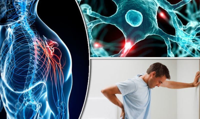 Click to enlarge Multiple sclerosis i