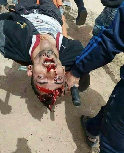 Ahmad Abu Naqil, 25, executed by an Israeli Sniper firing an explosive bullet