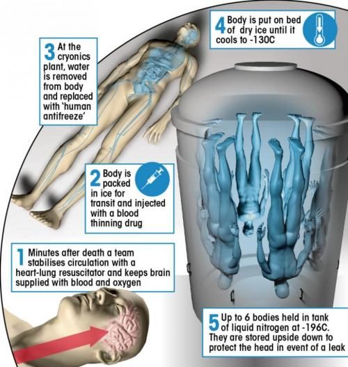 Click to enlarge cryogenic freezing