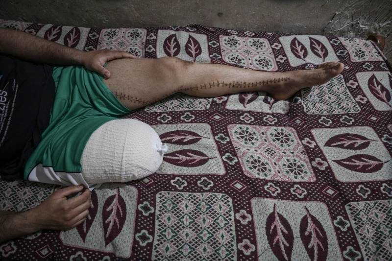 gaza wounded leg march of return IDF