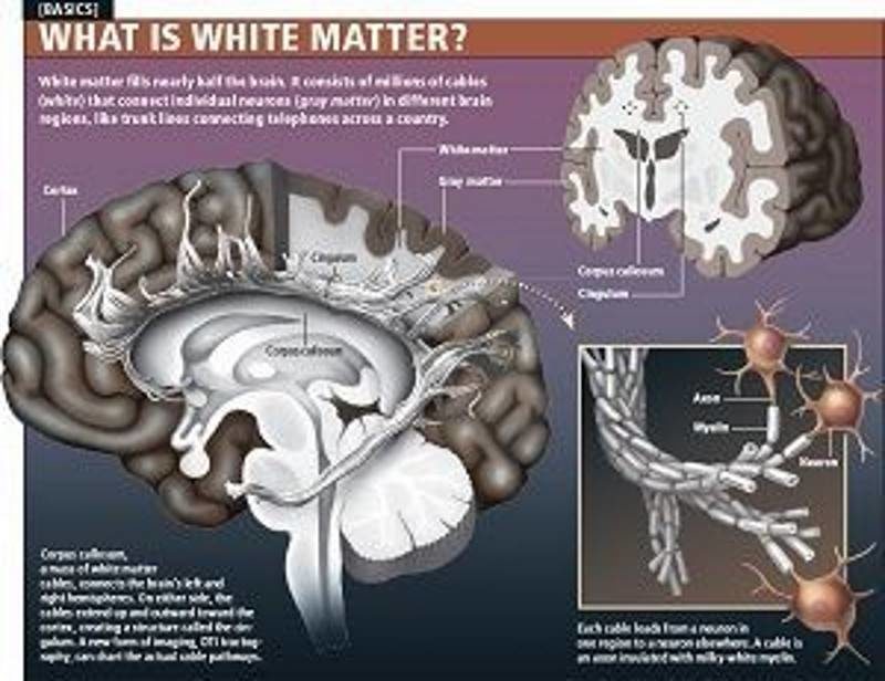 Click to enlarge brain white matter