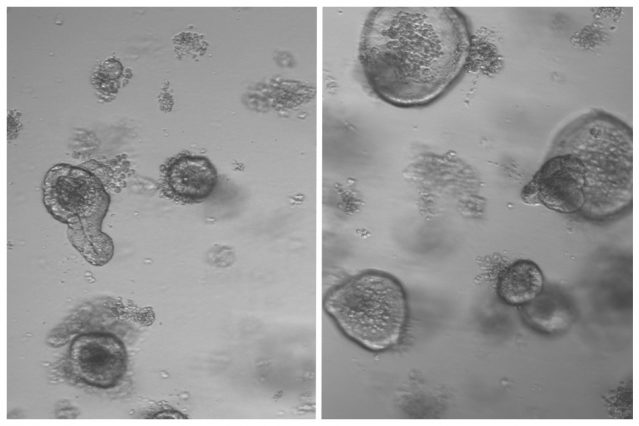 Click to enlarge intestinal stem cells