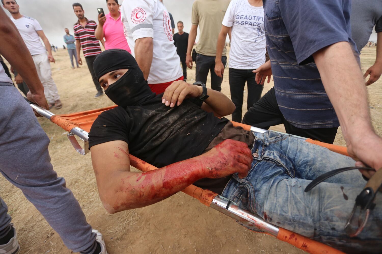 Click to enlarge Injured protestor Gaza 2018