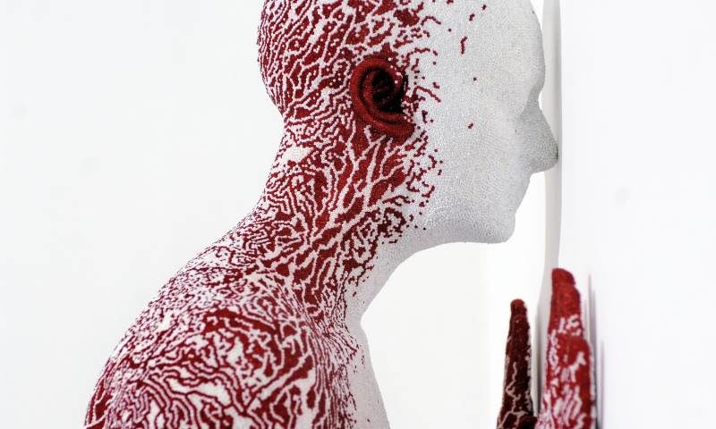 human scupture homeostasis