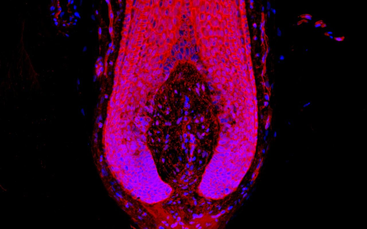 human hair bulb