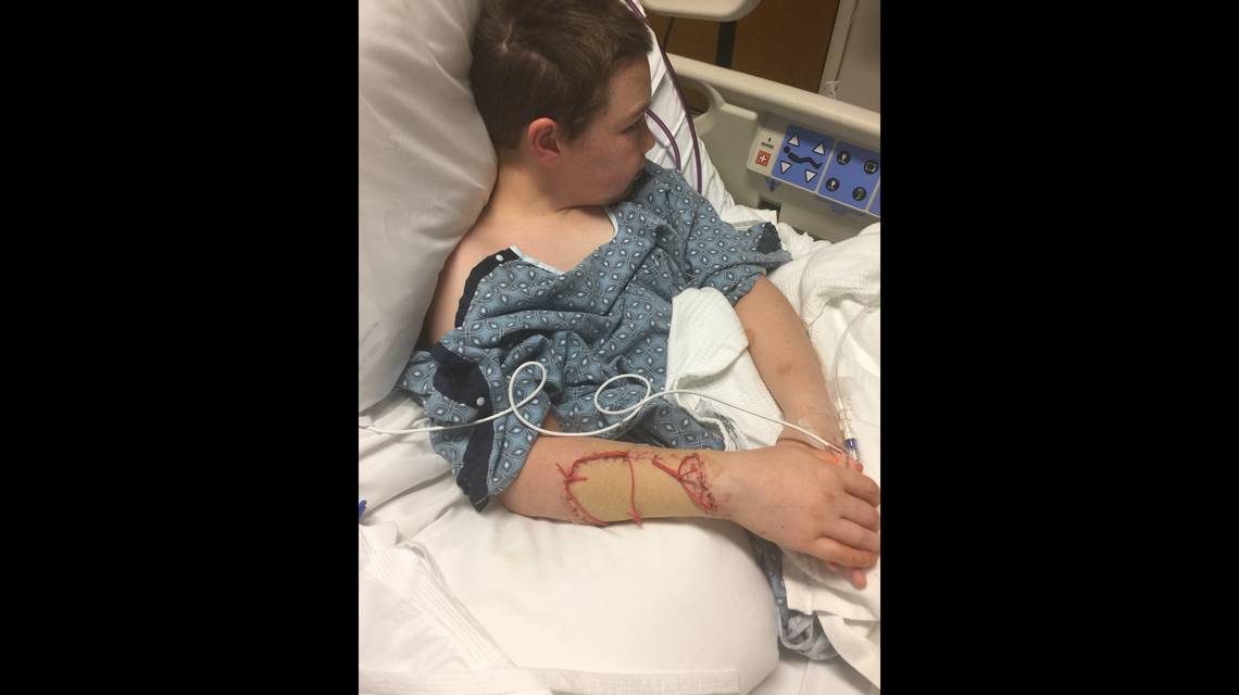 Jei Turrell, 10, was bitten by a shark while swimming at a Hilton Head Island beach on Sunday, May 13, 2018. He is recovering at the Memorial University Medical Center in Savannah.