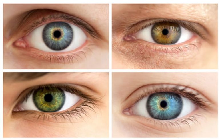 eye color