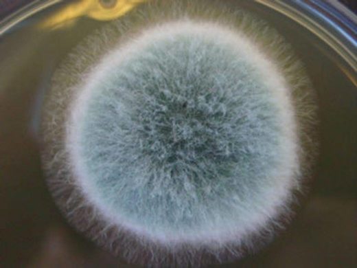 Click to enlarge Aspergillus fumigatus fungal infection