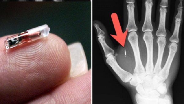 Click to enlarge microchip