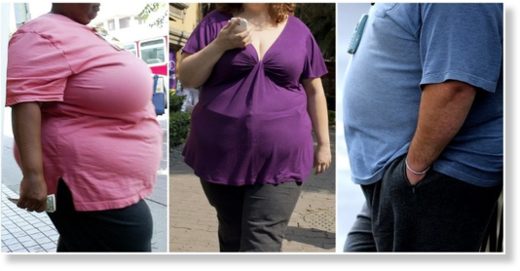 obesity