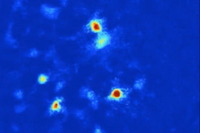 Click to enlarge Anxiety cells