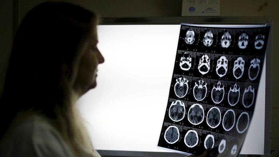 Click to enlarge Brain injury US worker China
