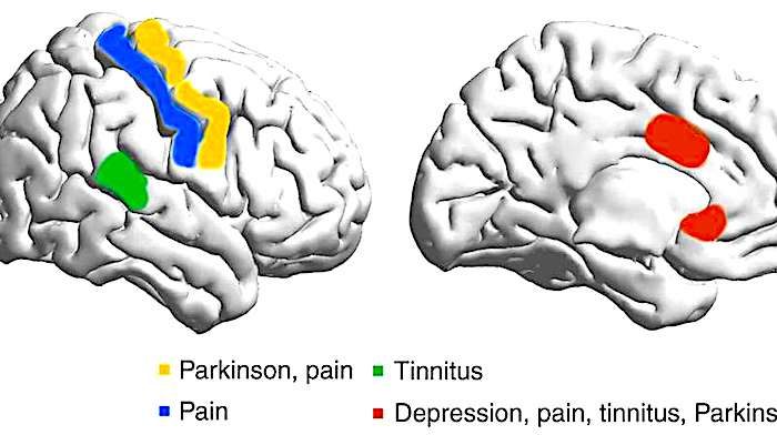 Click to enlarge 2Brains