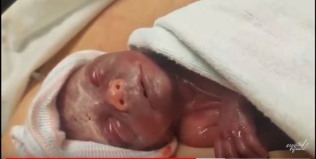 premature baby