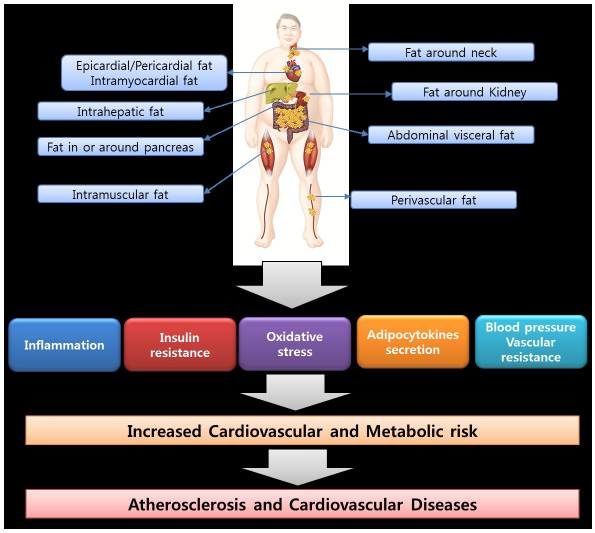 ectopic fat metabolic syndrome