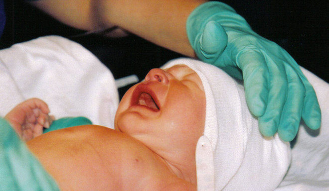 circumcision