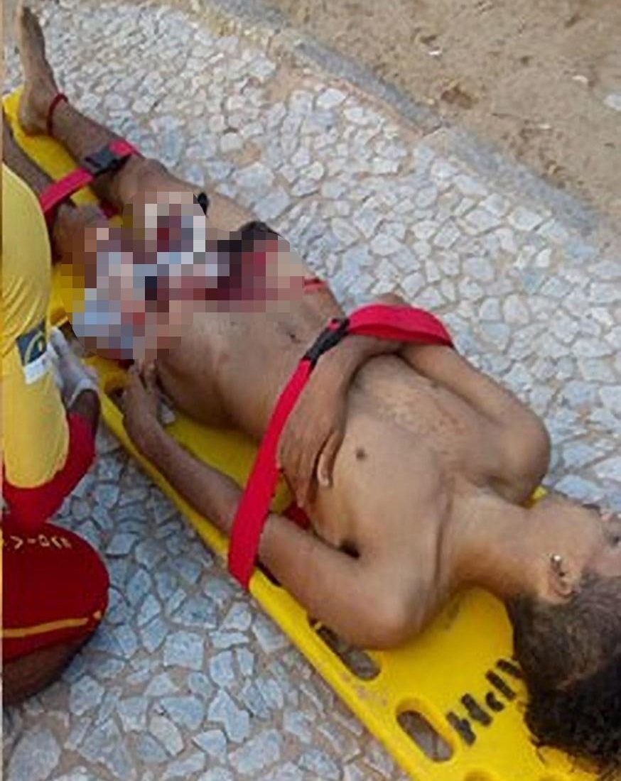 Click to enlarge A teen has died after he had his penis and leg torn off in a horrific shark attack off a Brazilian beach