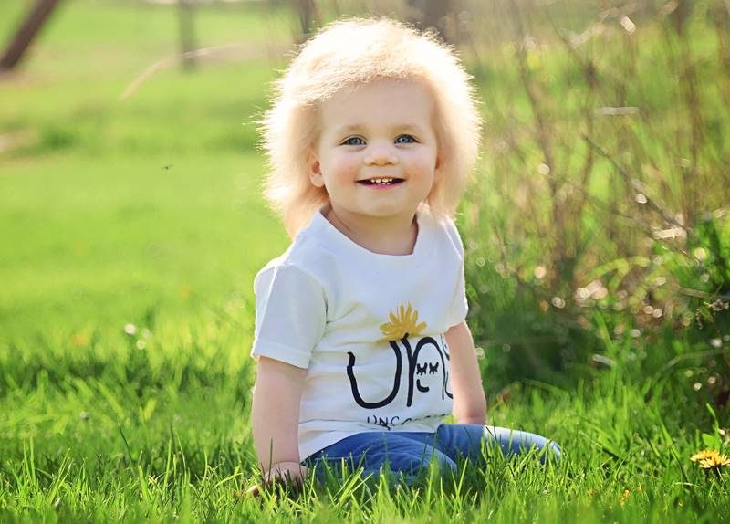 uncombable hair syndrome