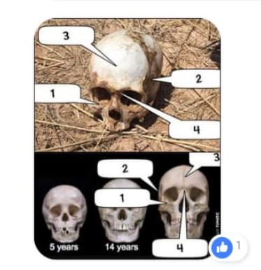 skull
