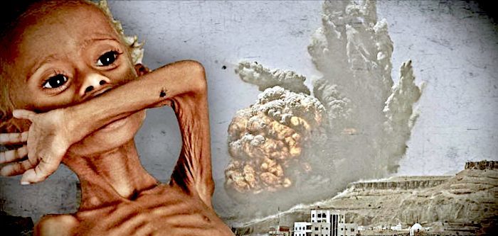 Click to enlarge Starving child, explosion
