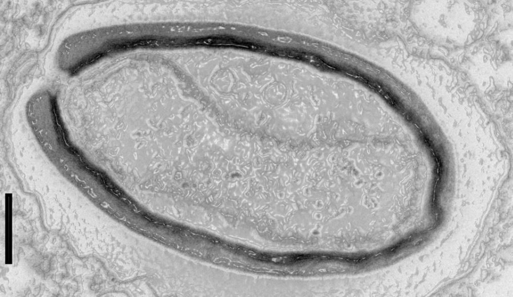 Click to enlarge Pandoravirus quercus virus
