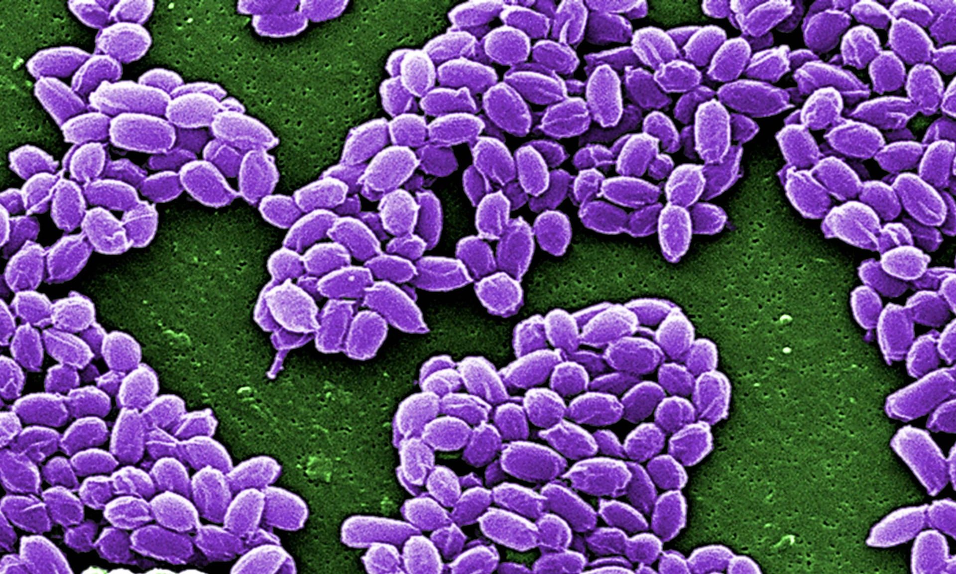 Click to enlarge anthrax spores