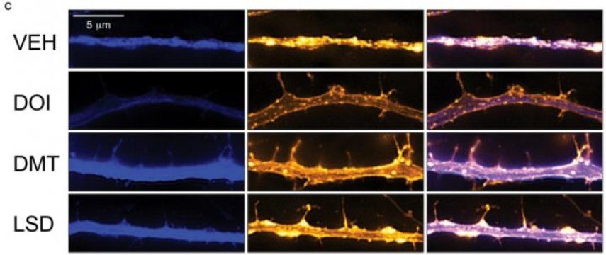 psychedelics effect on cortical neurons