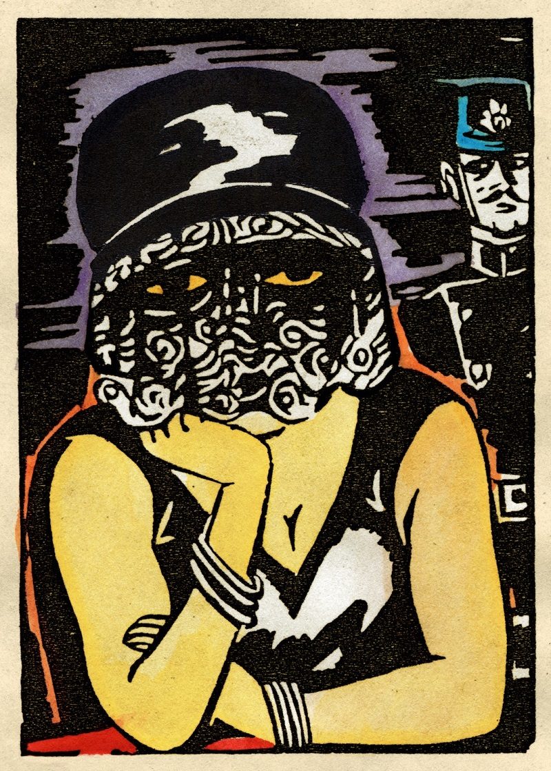 Click to enlarge Syphilis
