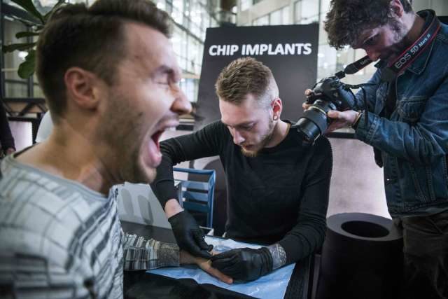 Click to enlarge chip implant
