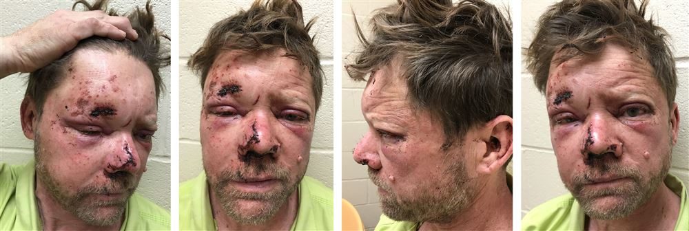 Perry Lawry assault Pennsylvania police