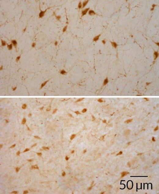Click to enlarge hypocretin narcolepsy addiction