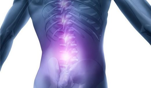 Click to enlarge back pain