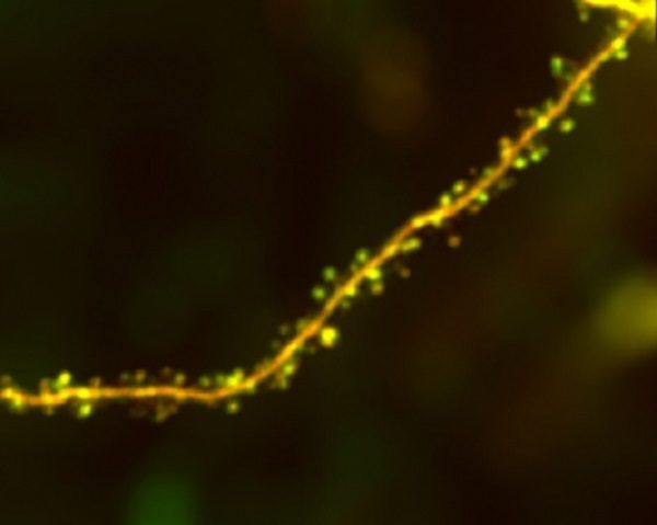 Dendrite Arc