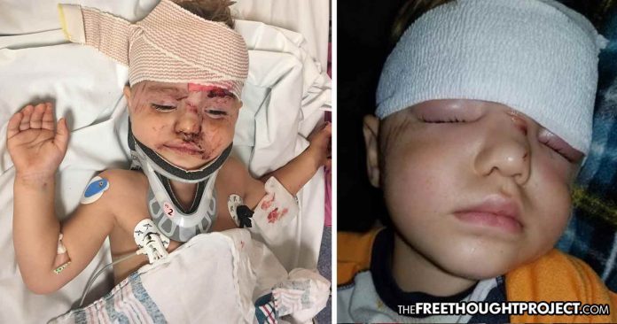 injured toddler