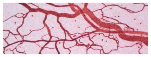 Click to enlarge Clean Arteries