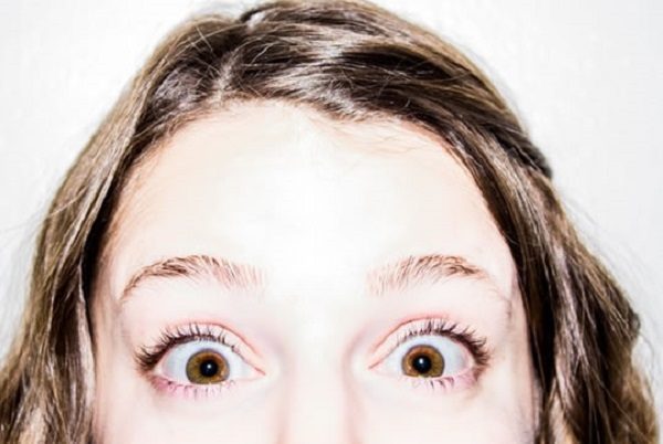 surprise
