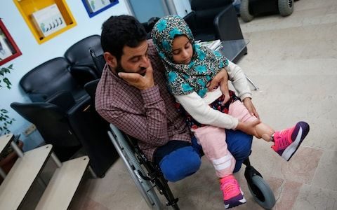 Maya Meri prosthetic legs