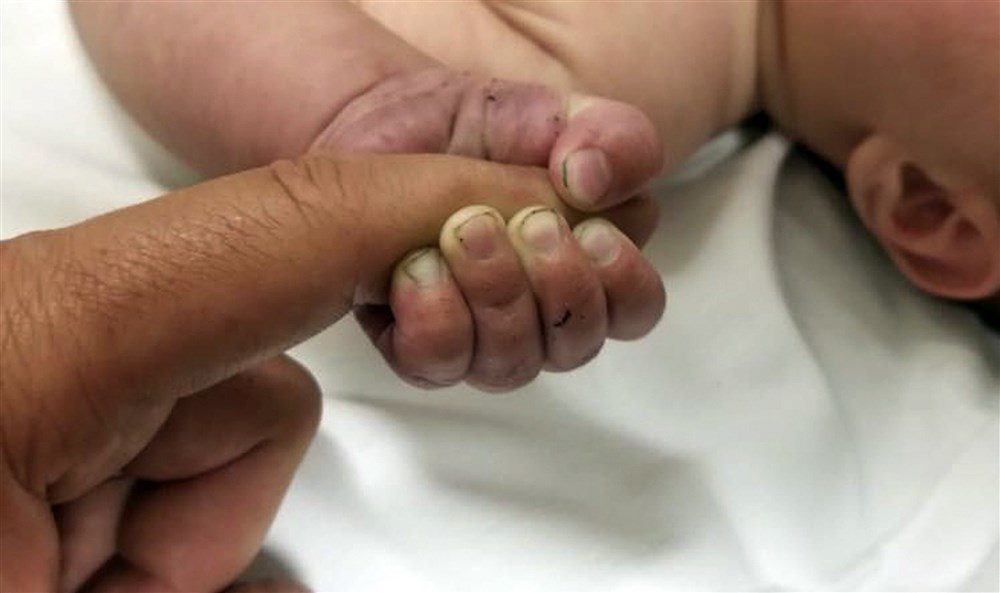 miracle baby