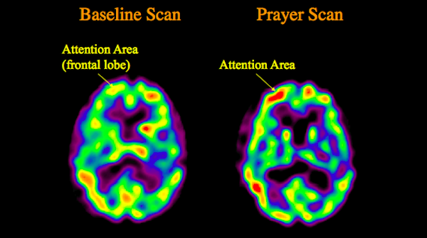 Click to enlarge brain scans