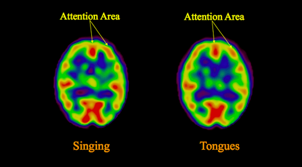 Click to enlarge brain